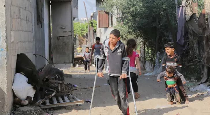 10 أطفال يفقدون سيقانهم يوميًا في غزة