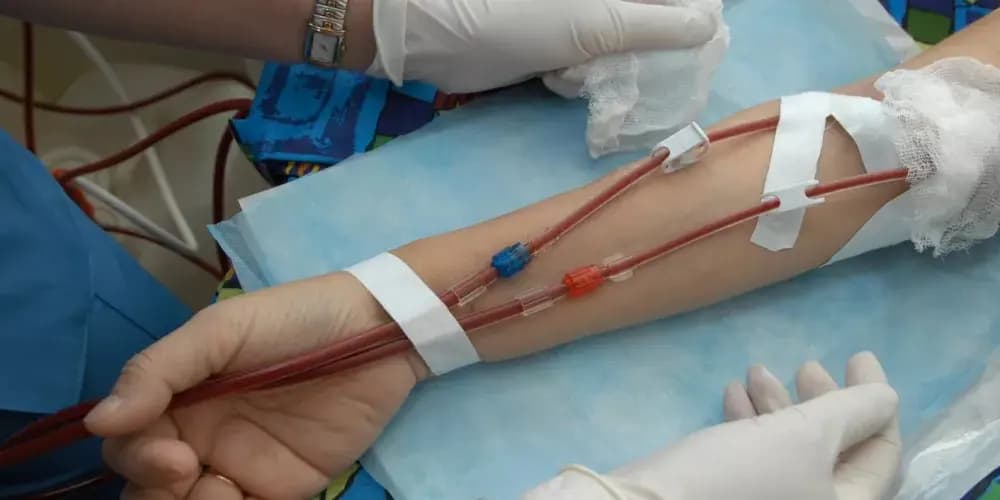 بشرى "سارّة" لمرضى غسيل الكلى