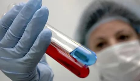 أميركا تسجل أول إصابة بشرية شديدة بـ"إنفلونزا الطيور"
