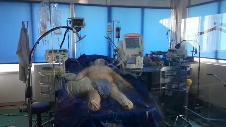 أضرم النار بزوجته لإرغامها على اجهاض جنينهما