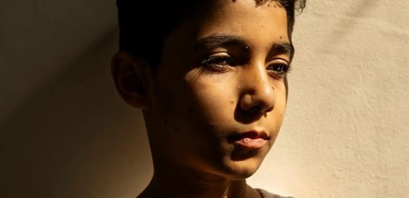 "كيف سأعانقك بلا ذراعين؟".. صورة لطفل فلسطيني تفوز بجائزة عالمية