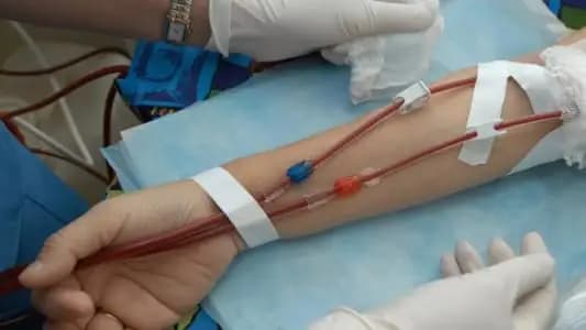 مرضى غسيل الكلى يتعرّضون للموت... إليكم السبب