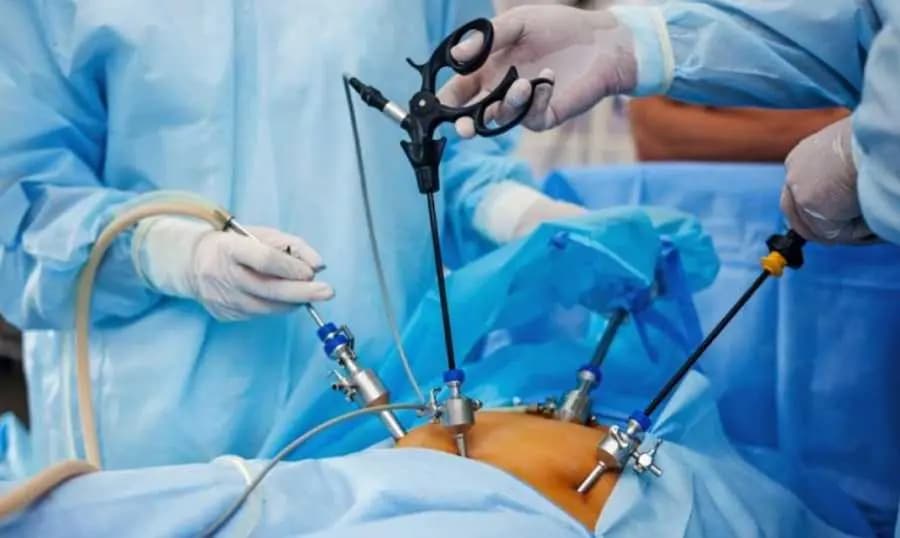 بعدَ وفاة وديع وسوف.. أطبّاءٌ يتحدّثون عن "مخاطر وفوائد تصغير المعدة"