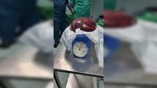 في لبنان... إنجازٌ جراحيّ جديد