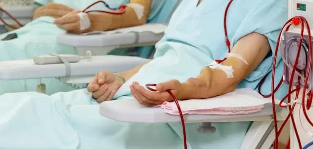 تعاونية موظفي الدولة تعدل تعرفة جلسة غسل الكلى
