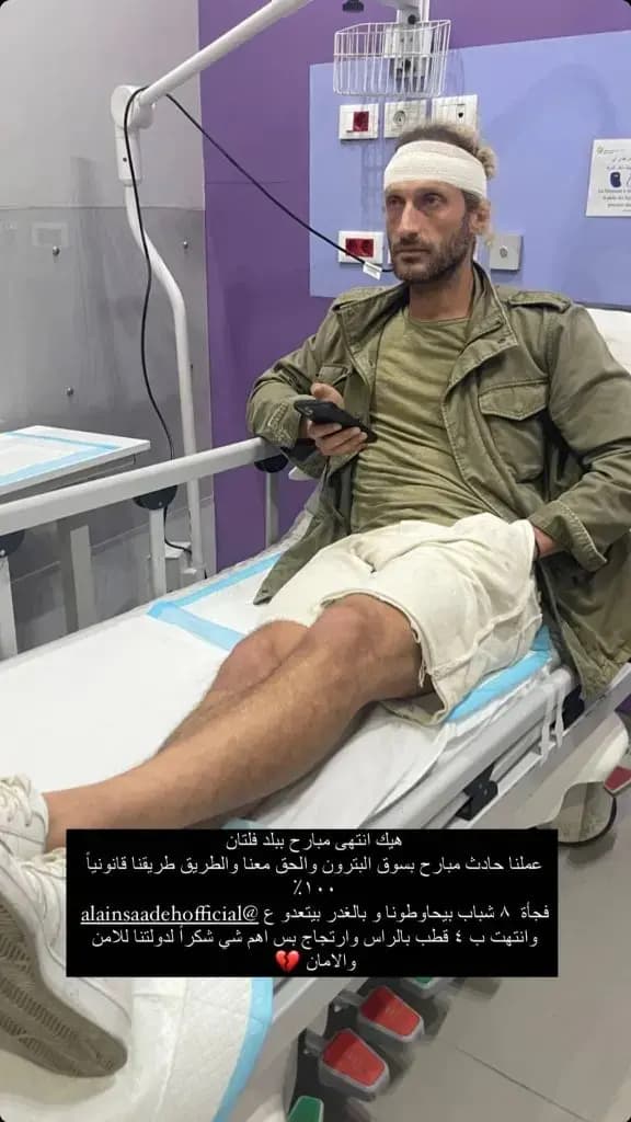 ممثّل لبناني يتعرّض للضرب.. وارتجاج في المخّ!