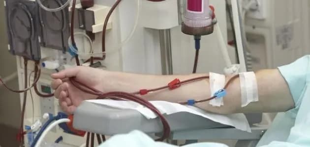 نقابة أصحاب المستشفيات تطالب بتعديل تعرفة غسيل الكلى