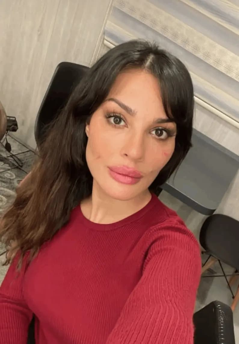 "بجروح على وجهها".. نادين نجيم تُقلق الجمهور
