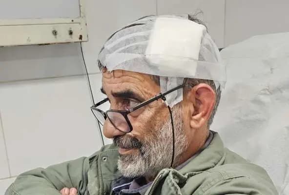 إصابة "مصوّر" بالغارة على صور
