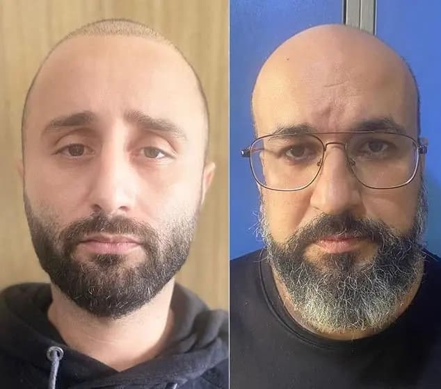 " يتحرشان بالقُصَّر".. هل وقعتم ضحيّة أعمالهما؟