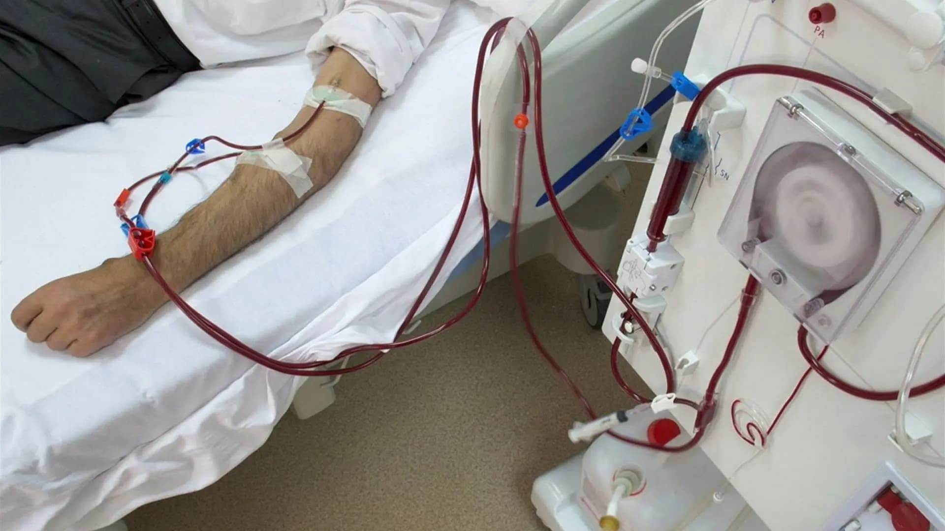خبر سار لمرضى غسيل الكلى