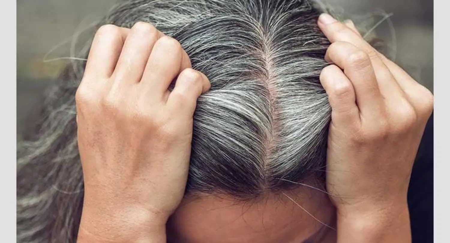 "ليس فقط التقدم بالعمر".. تعرفوا على أسباب أخرى للشيب المبكر