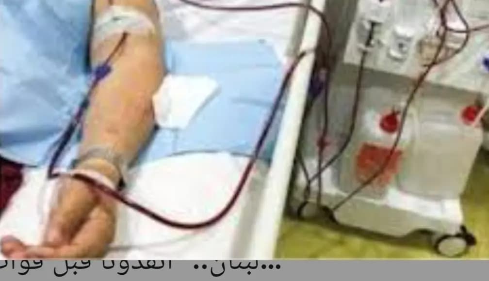 وزير الصحة: مستمرون في دعم مرضى الكلى!