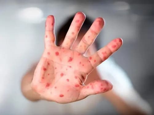 خطر وبائي يُهدّد لبنان.. وتحذير عاجل من وزارة الزراعة