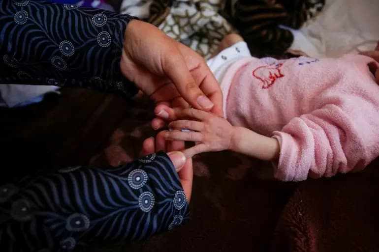 "حالة صادمة وغير مسبوقة".. طفلة من دون دماغ!