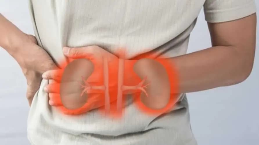 لحماية الكلى.. تجنبوا هذه العادات