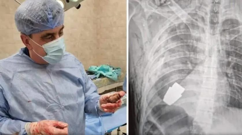 قنبلة حيّة.. ومعجزة طبيّة في أوكرانيا!