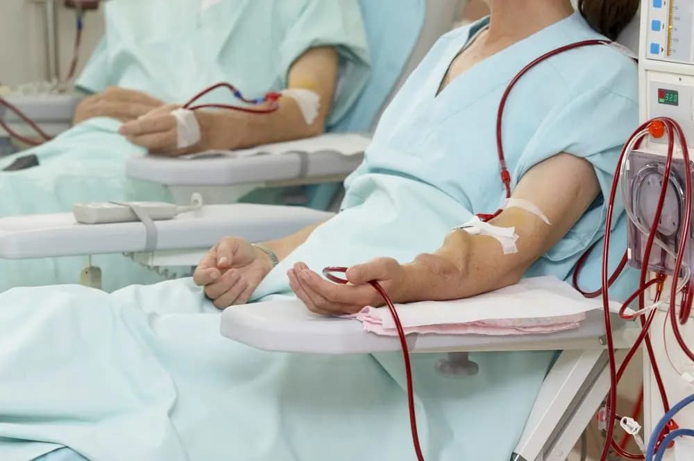 رفع تعرفة غسيل الكلى.. كم أصبحت؟