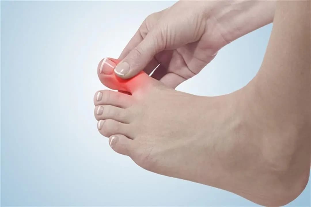 هل تعاني من حكة بين الأصابع.. إليك السبب؟