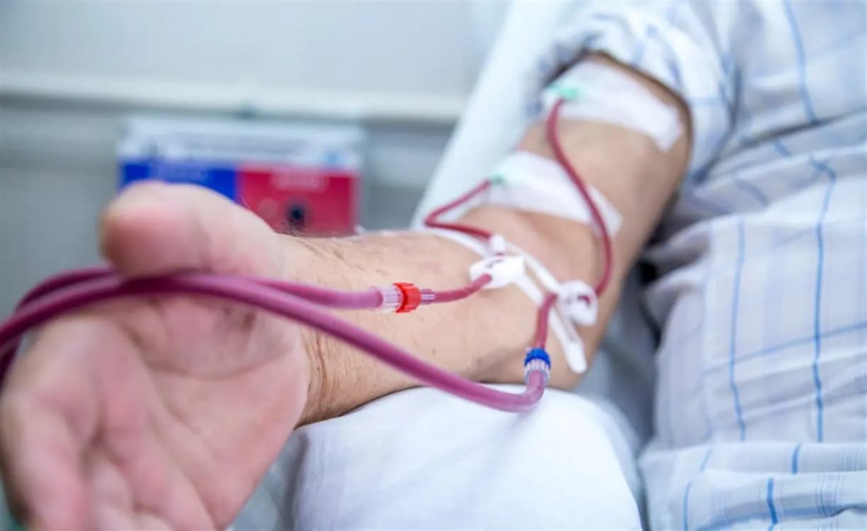 رفع تعرفة غسيل الكلى.. كم أصبحت؟